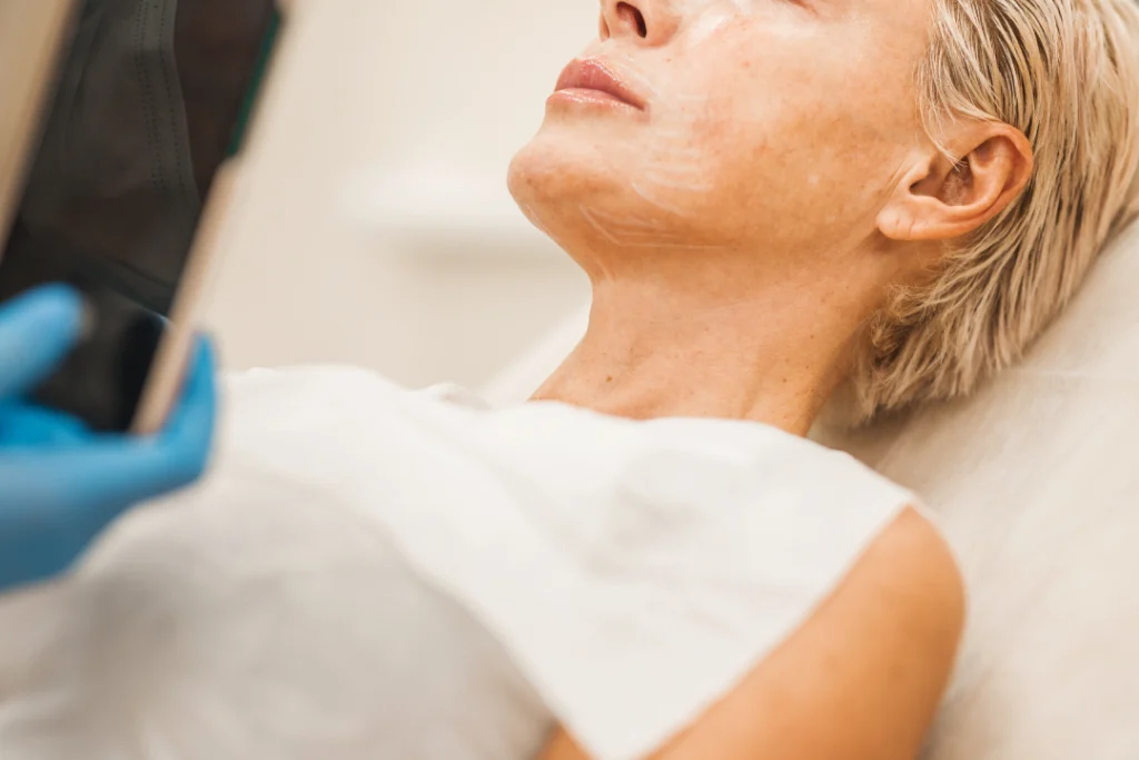 A patient undergoing a PDO threads treatment on the neck for skin tightening.