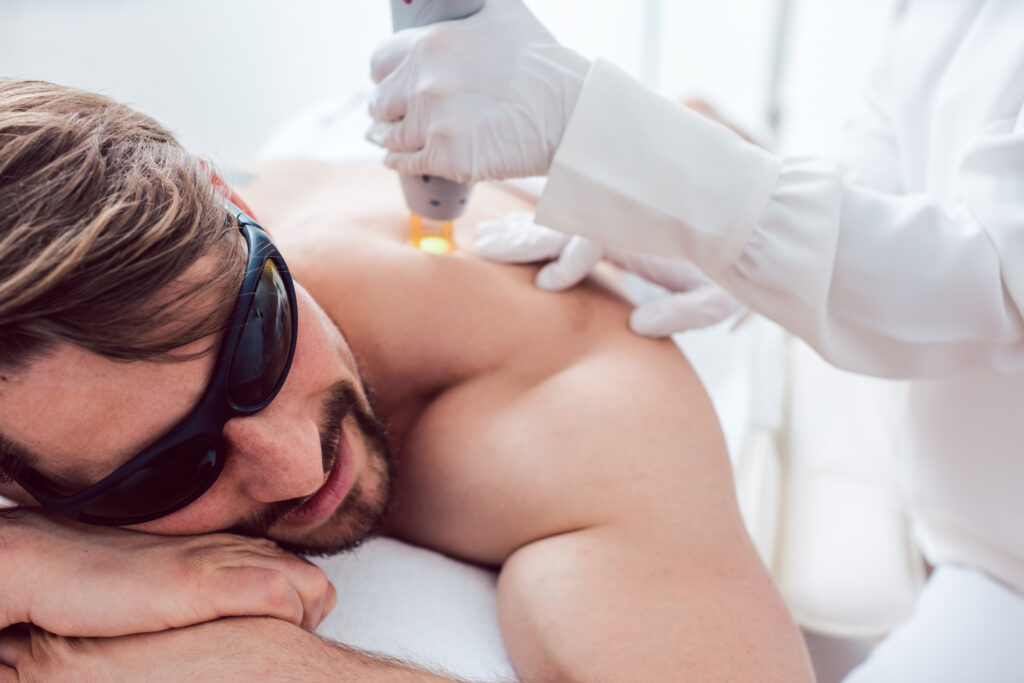 A man undergoing a laser hair removal session on his back at a professional clinic