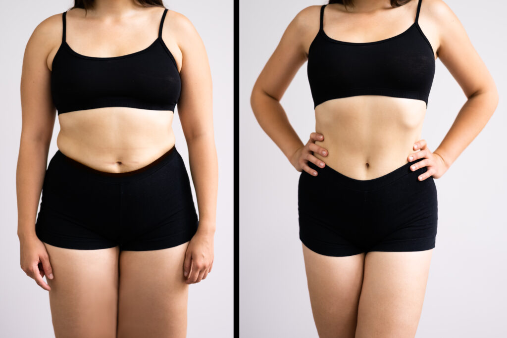 Before and after weight loss transformation of a woman in black athletic wear, illustrating tirzepatide’s effectiveness.