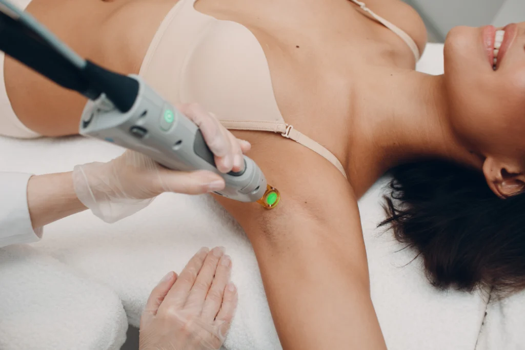 A professional performing a laser hair removal session on a woman's armpit using a specialized device.